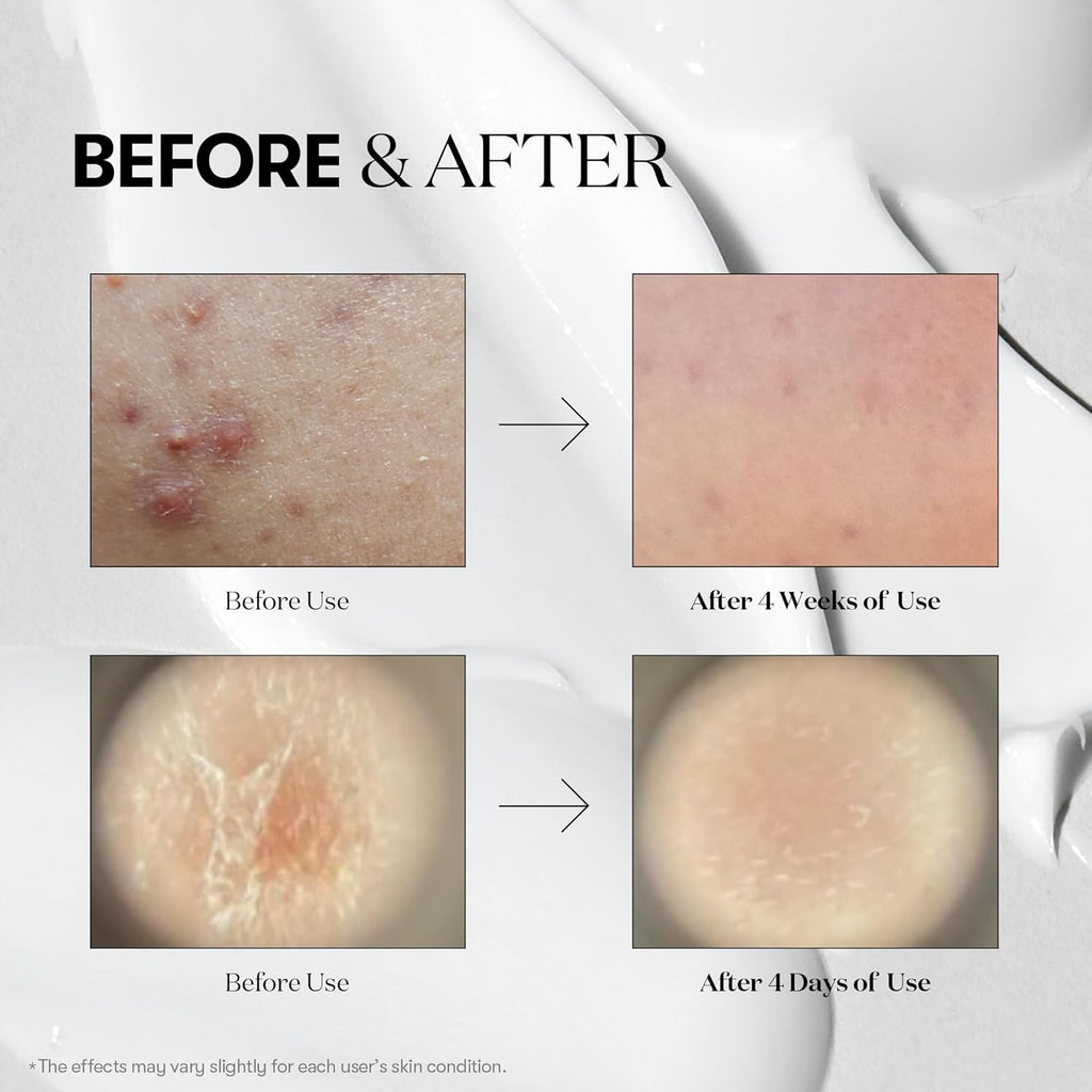 VT Cosmetics Reedle Shot 300