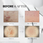 VT Cosmetics Reedle Shot 300